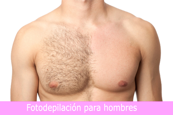 Fotodepilacion para hombres en C'est Si Bon